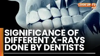 3D and 2D imaging X-rays