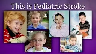 A Stroke Can Happen at Any Age