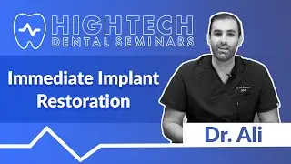 Dr. Ali - Immediate Implant Restoration
