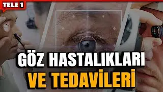 Astigmat ameliyat sonrası ilerler mi? | SAĞLIK G&Uuml;NDEMİ  (10 AĞUSTOS 2025)