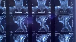 Blue Thermal Medical Film