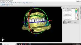 BSB Digital Denture Update v 4.3.0 Tutorial