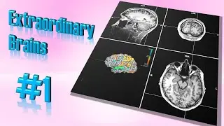 The Man Who Has Almost No Brain | Extraordinary Brains #1