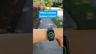 What causes runner&rsquo;s itch?