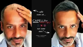 Applicazione Protesi Capillare 5° Dimensione Capelli for You