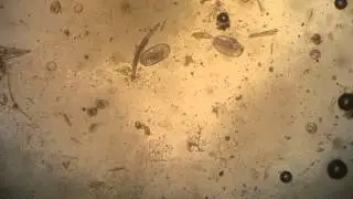 Active Strongyle Larvae in Horse Fecal