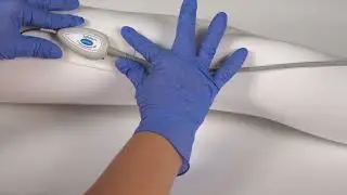 Kendall&trade; Fetal Spiral Electrode System