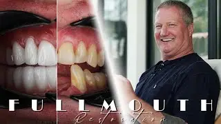 Full Mouth Restoration / Testimonial