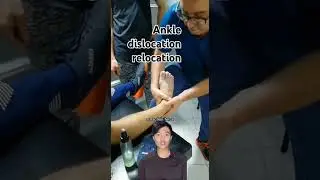 Ankle dislocation relocation