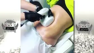Best Fat Reduction Treatment Glasgow With T-Shape Machine At Million Dollar Brows Clinic