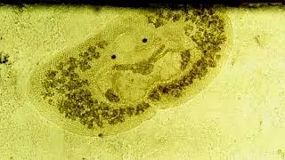 220608 Transversotrema patialense - fish ectoparasite digenetic trematode