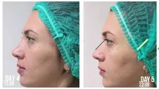 Olga Nishcheta in the  Open Category of The Skin Games 2019 | Week 5