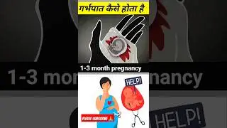 abortion procedure( 3D Animation) #shorts #shortsvideo #pregnancy #viral #viralvideo #share #foryou