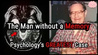 Patient HM: The Man Without a MEMORY
