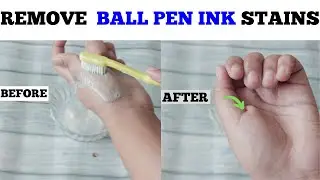 How To Remove Ballpoint or Pen Ink Stains from Hands with Home Solution