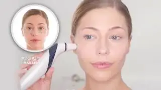 Homedics Radiance Microdermabrasion System