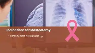 Mastectomy