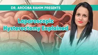 Laparoscopic Hysterectomy Explained | Procedure, Benefits & Recovery | Dr. Arooba Rahim