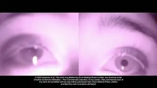 Smartphone Infrared Pupillography and Pupillometry - Supplementary video 4 [ID 331989]