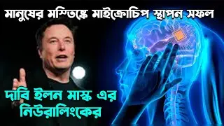 মানুষের মস্তিষ্কে মাইক্রোচিপ স্থাপন সফল, দাবি ইলন মাস্ক এর নিউরালিংকের|
