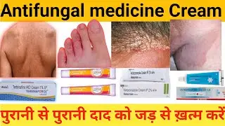 Antifungal Cream // पुरानी से पुरानी दाद को जद से ख़त्म करे || संपूर्ण जानकारी हिंदी में