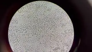 URINE MICROSCOPIC EXAMINATION #PUS CELL #LAB TECHNICIAN 🔬