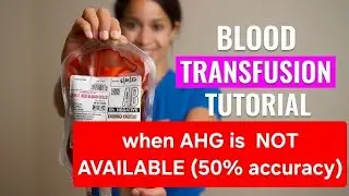 Rough Cross match When AHG is not available (50% accuracy),blood transfusion #science #labtech