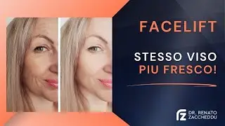 Facelift Naturale: Ringiovanire Il Volto Senza Stravolgerlo