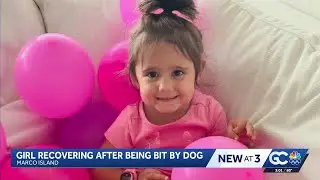 3-year-old girl hospitalized after dog bite to the face on Marco Island