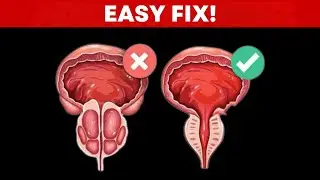 Do These 3 Exercises to Shrink an Enlarged Prostate Especially for Those Over 50