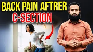 Back Pain after C Section | Postpartum Lower Back Pain