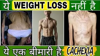 Cachexia ka management & prevention||Weight loss, muscle loss aur weakness kyun hoti hai#cachexia