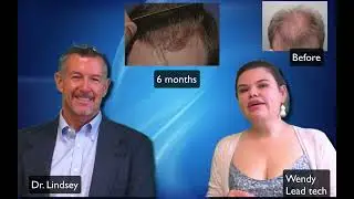 Great early hair transplant growth, younger patient bushy hair by Dr. Lindsey in Washington | VA