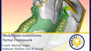 Dentalligent-Full Video- Modellguss modellieren - Partial Framework