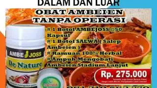 Obat Wasir Stadium 2