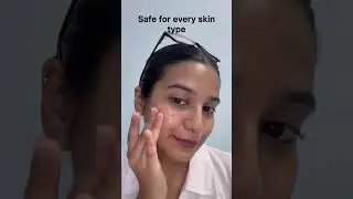 Vitamin C Face Serum at ₹299 ✨ | Bright Skin & Dark Spot Care