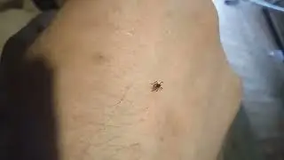 23.07.2024 Plagegeist Zecke nach Brombeerernte (Sch&auml;dling)