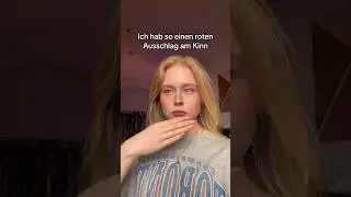 Beard Burn entsteht wenn der Bart ungepflegt ist #beziehung #beziehungstipps #girlssupportgirls