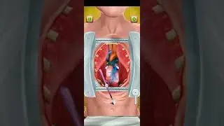 Emergency Hospital Surgery Simulator: Doctor Games Level 11