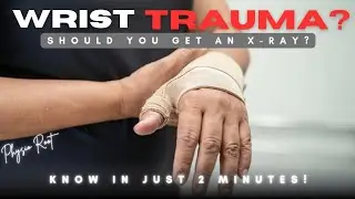 Wrist Injury? Use Karadeniz Wrist Rule Before X-Ray | Clinically Proven in Just 5 Tests!