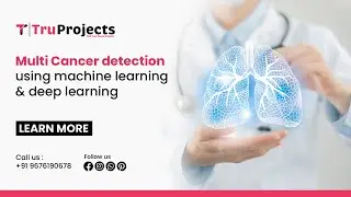 Multi Cancer detection using machine learning and deep learning   Btech projects  Mtech projects