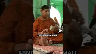 The Secret Rat Children of Pakistan