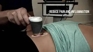 Aspen Laser: Class IV Lasers with True Dual Wavelength Technology for Fast Pain Relief