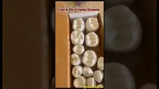 A Day in Life Of Dental Students 🦷at Purvanchal Institute of Dental Science#bds#dentistry#medico