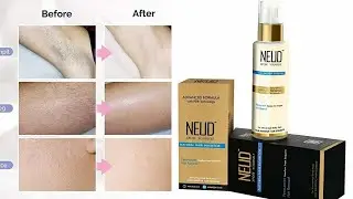 NEUD Natural Hair Inhibitor for Permanent Reduction of Unwanted Body and Facial Hair in Men & Women