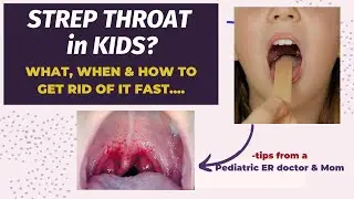 Strep Throat in Kids: How to know, When & How to treat by a Pediatrics ER doctor