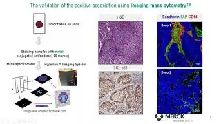 Understanding the immunosuppressive functions of CAFS in Lung Cancer