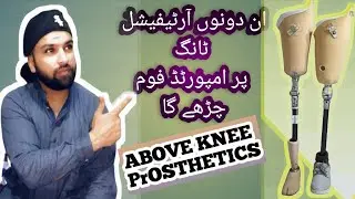 ABOVE KNEE prosthesis Madular Turkey systam polycentric joint+ constant friction join #ottobock #leg