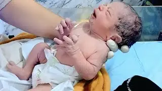 Post-NVD Newborn Care | Initial Assessment, RBS Monitoring & Education#newborn#nicucare #cute #care