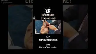 How to Measure #EYE Pressure THROUGH EYELID? only with Diaton #Tonometer #Tonometry #Glaucoma Test